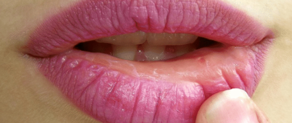 lèvres